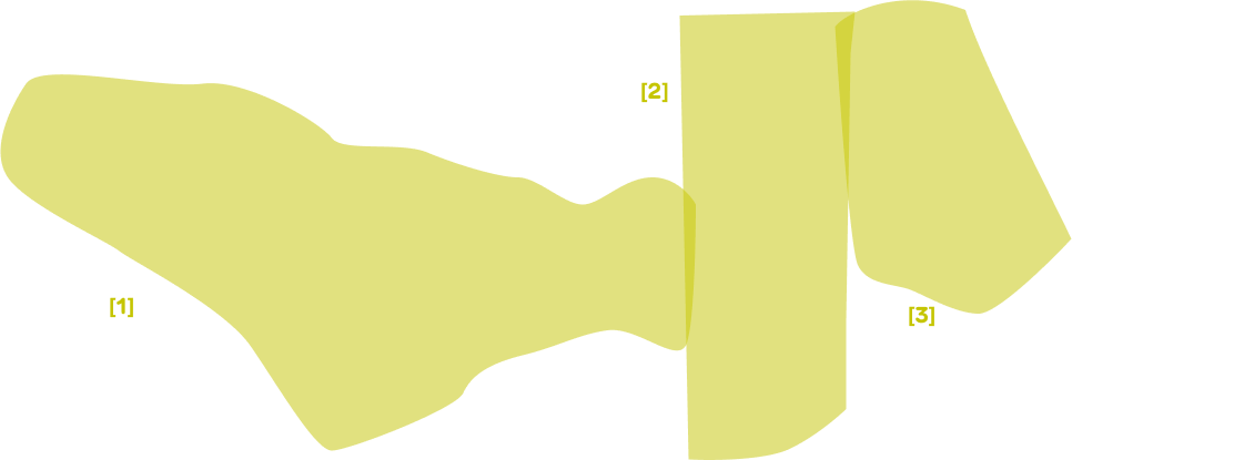 Urine Overlay